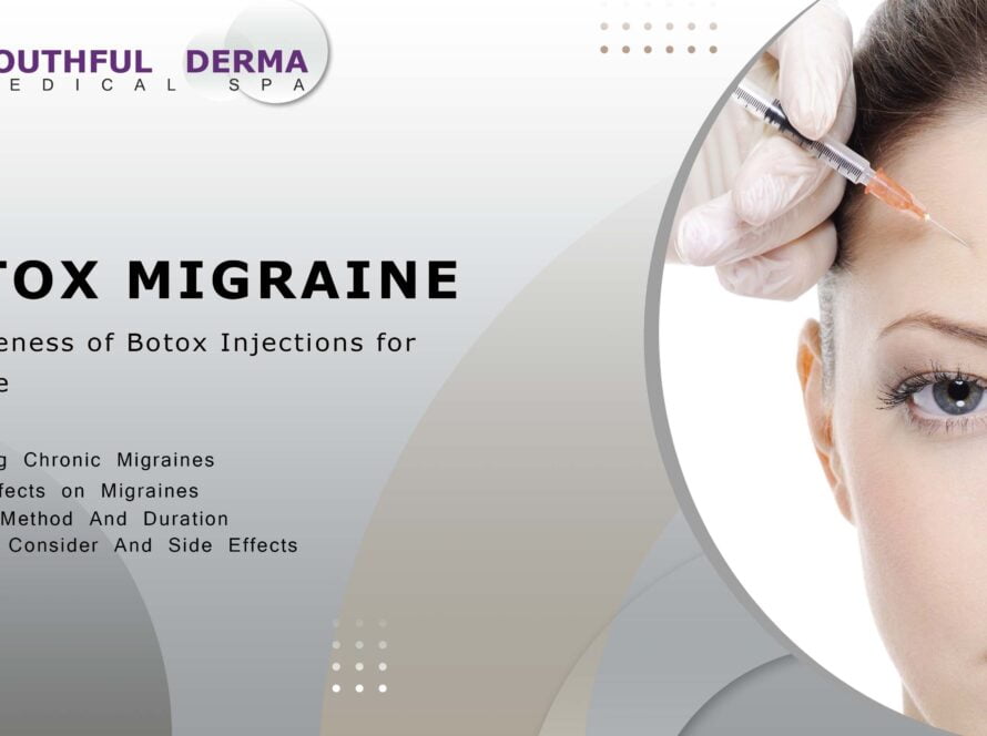 botox migraine treatment by youthfulderma