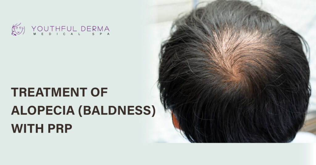 Treatment of Alopecia (Baldness) with PRP