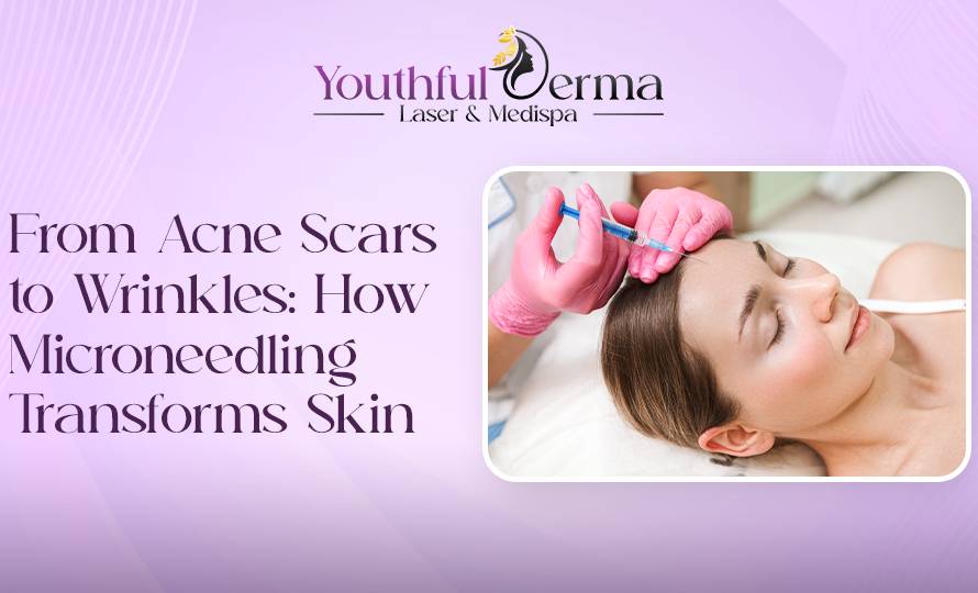 Acne Scars to Wrinkles: How Microneedling Transforms Skin