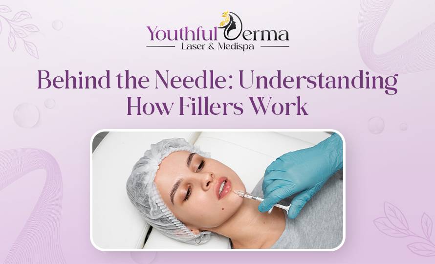 understanding how fillers work