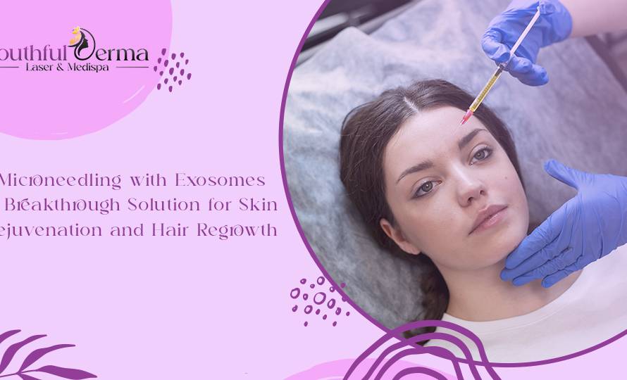 microneedling-with-exosomes