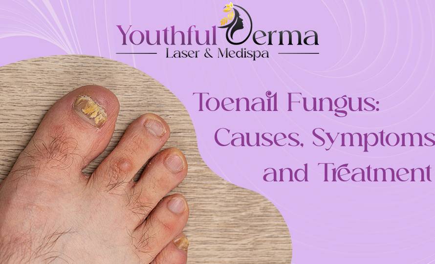 toenail-fungus-causes-symptoms-and-treatment