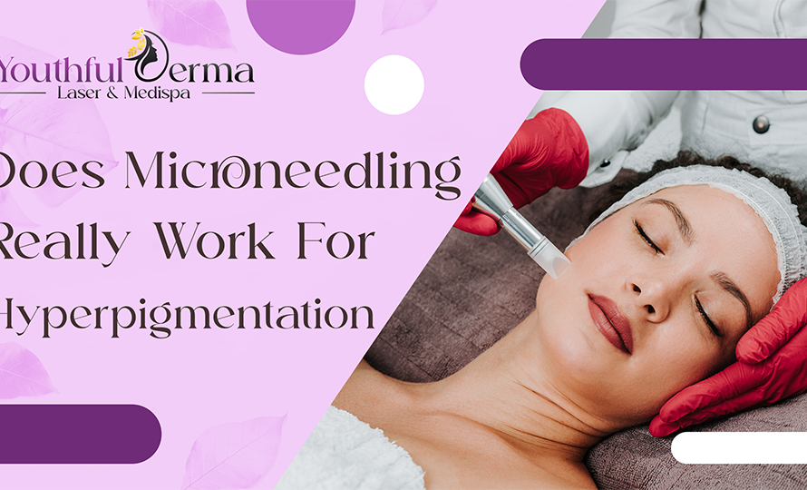 Does Microneedling Really Work for Hyperpigmentation?