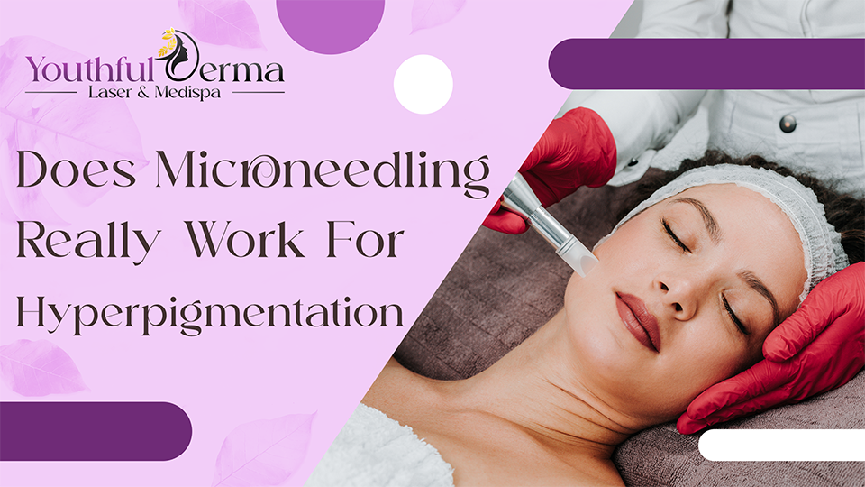 Does Microneedling Really Work for Hyperpigmentation?