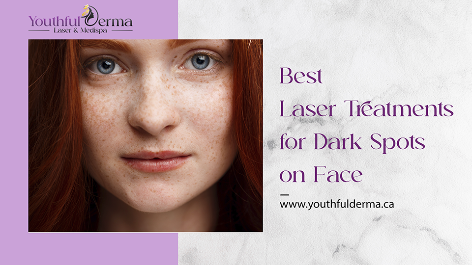 Our Blog 19 Best Laser Treatments for Dark Spots on Face