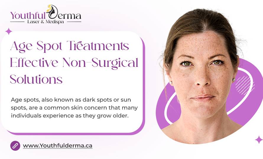 Age Spot Treatments Non-Surgical Solutions