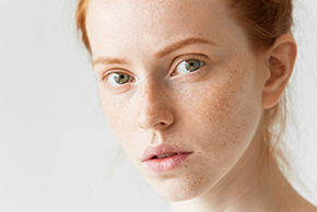 Best Facial Treatments for Sun-Damaged Skin 2 dark spots
