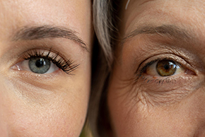 Best Facial Treatments for Sun-Damaged Skin 3 loss of firmness