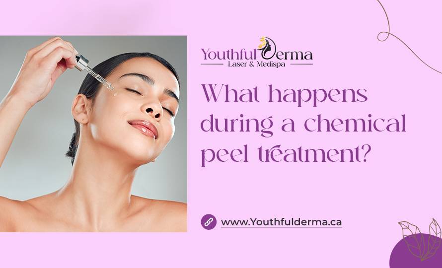 what-happens-during-a-chemical-peel-treatment