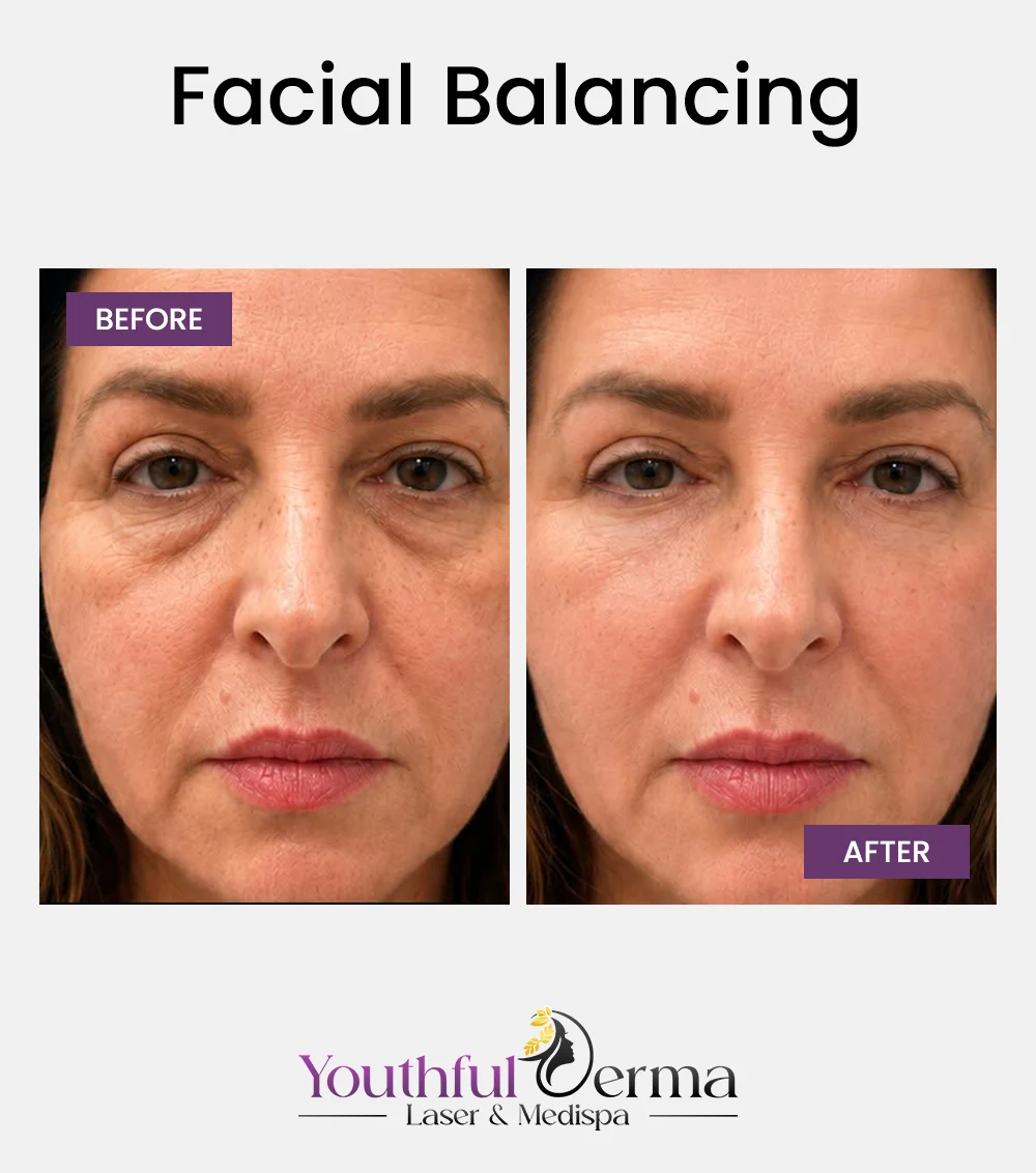 facial-balancing-before-&-after-1